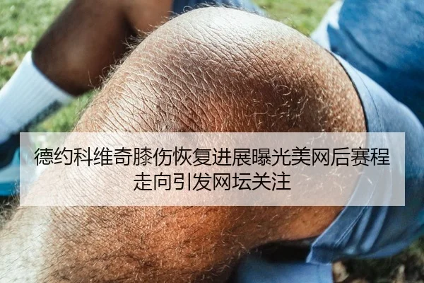 德约科维奇膝伤恢复进展曝光美网后赛程走向引发网坛关注